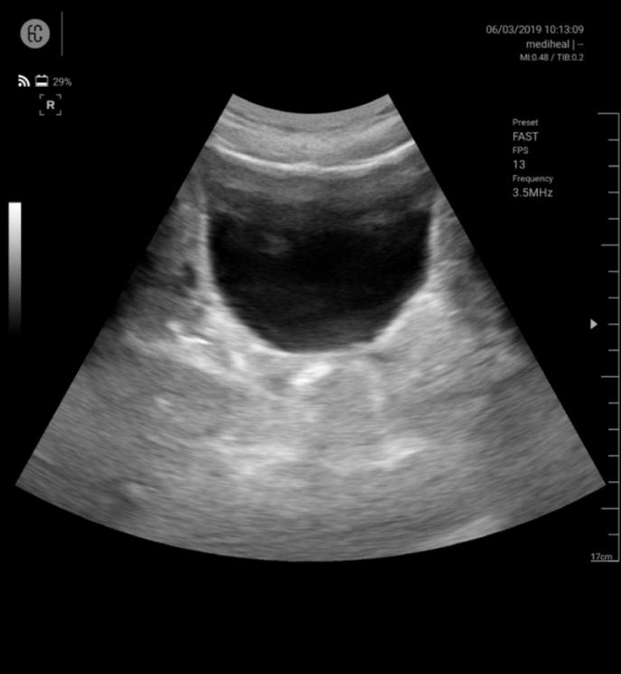 SONON 300C ecografía 1