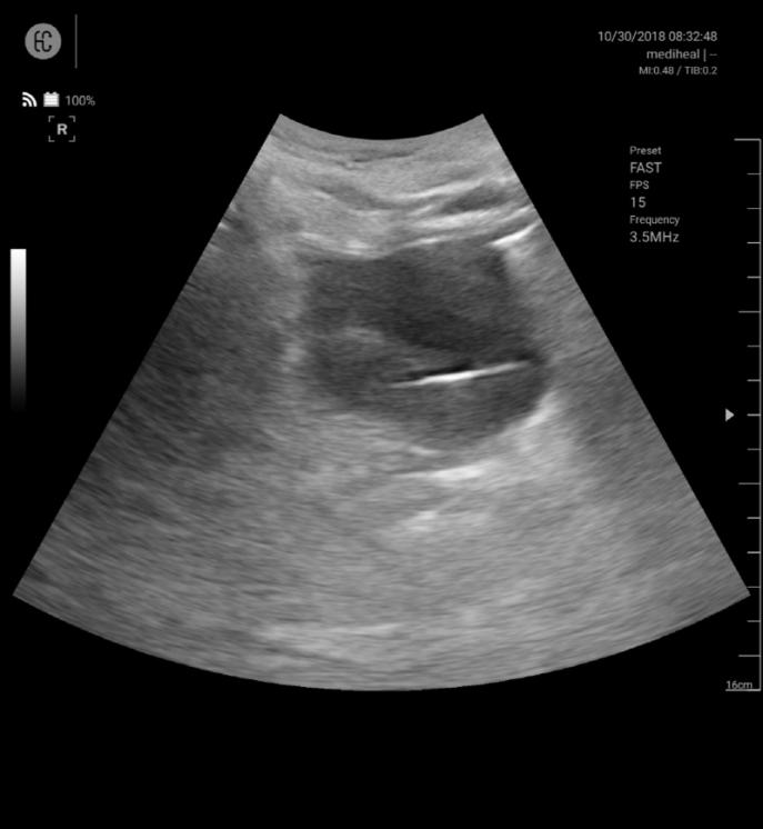 SONON 300C ecografía 2