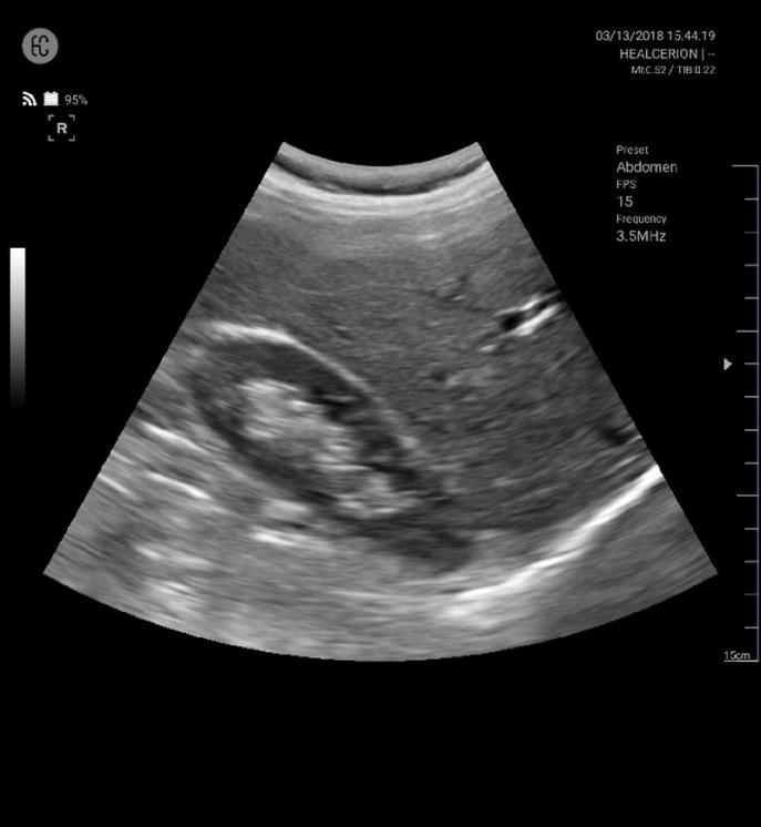 SONON 300C ecografía 4