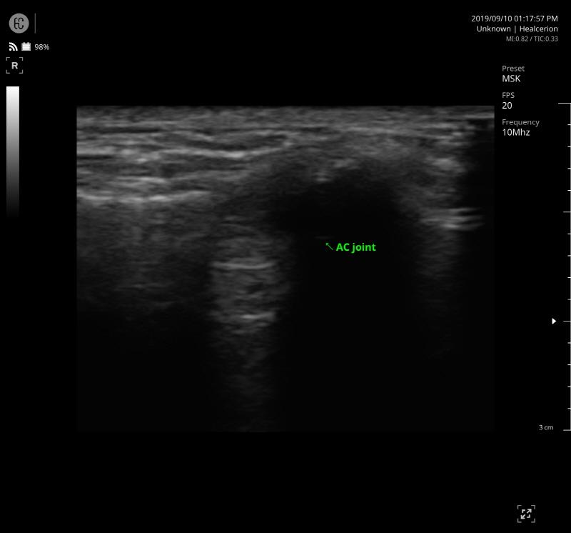 SONON 300L ecografía 2