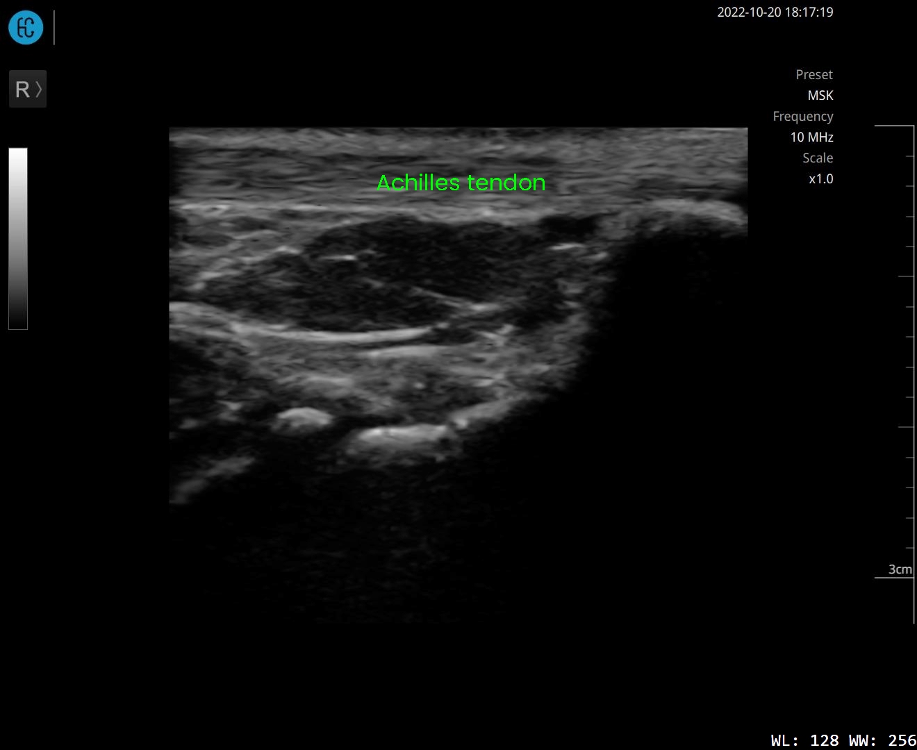 SONON 500L ecografía 1