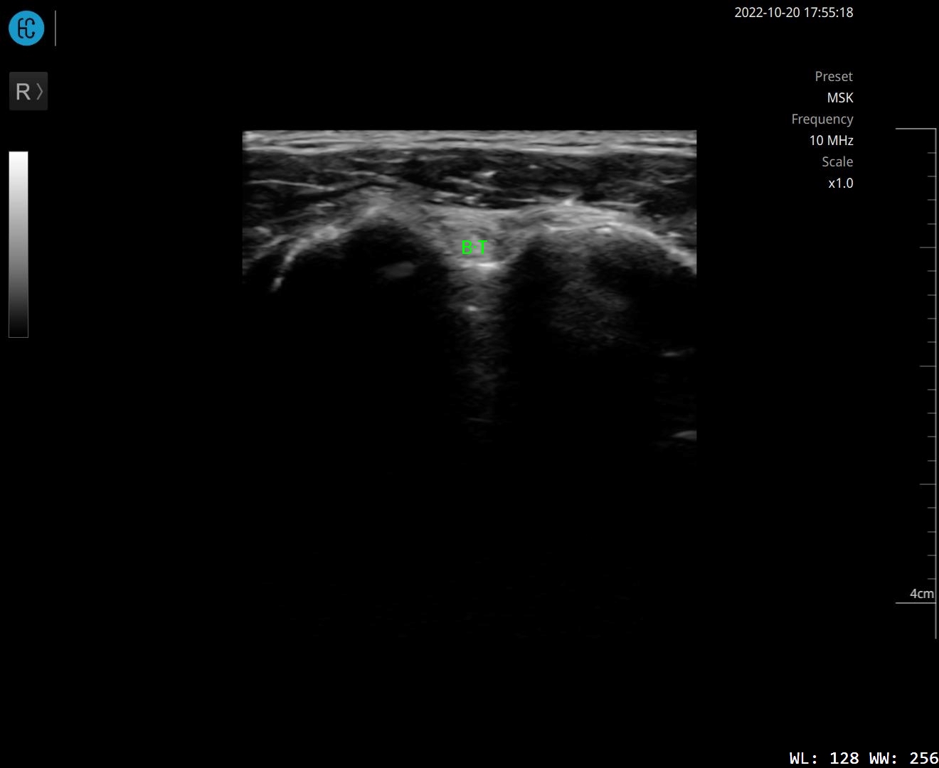 SONON 500L ecografía 2