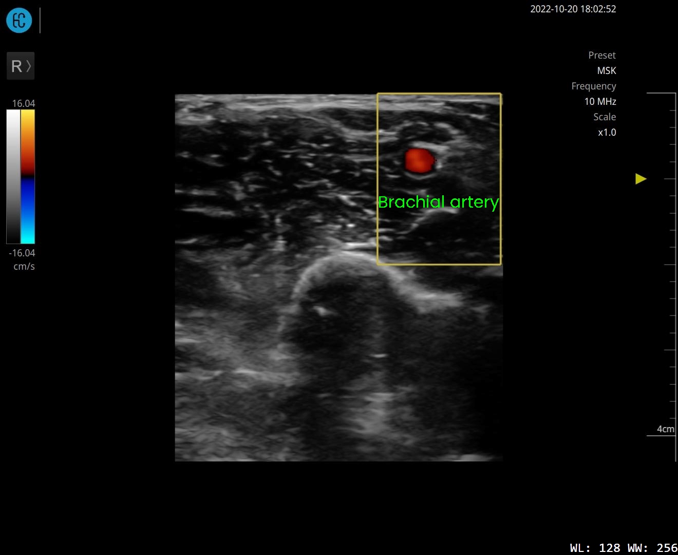 SONON 500L ecografía 3